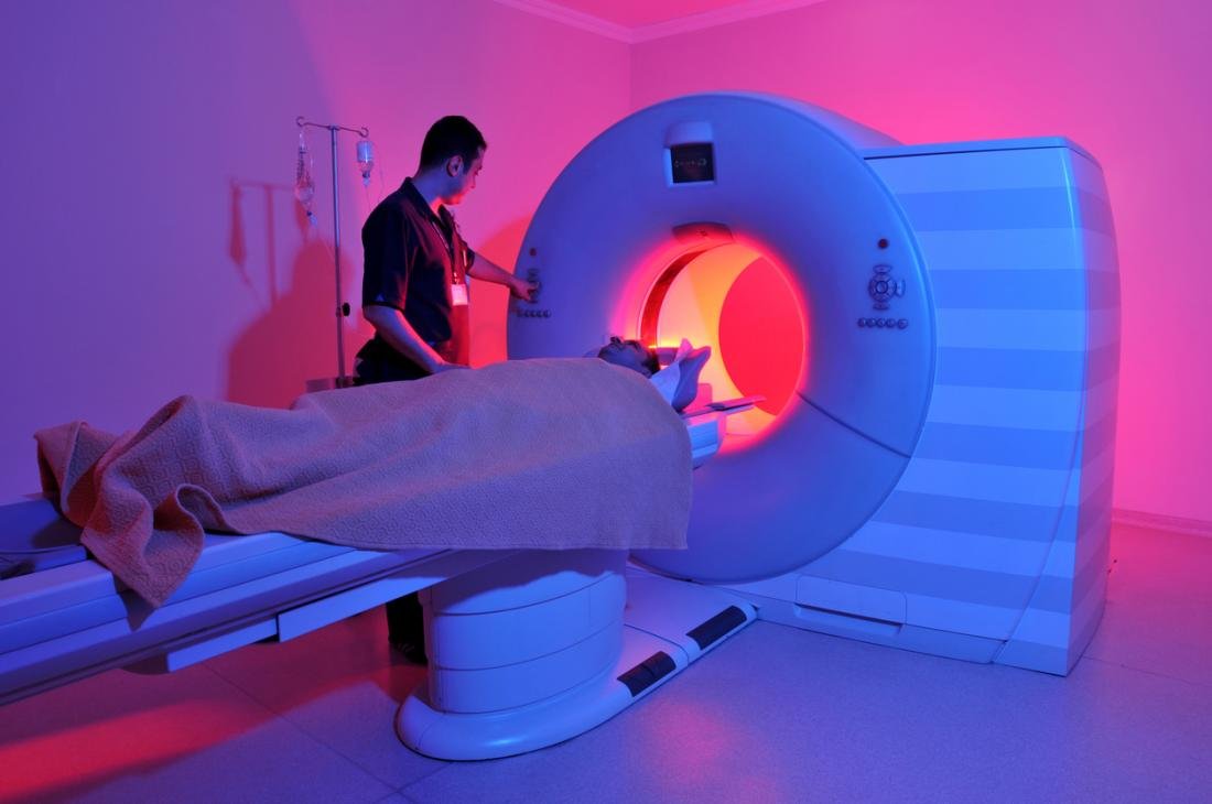 What Is an MRI and When Do You Need One?